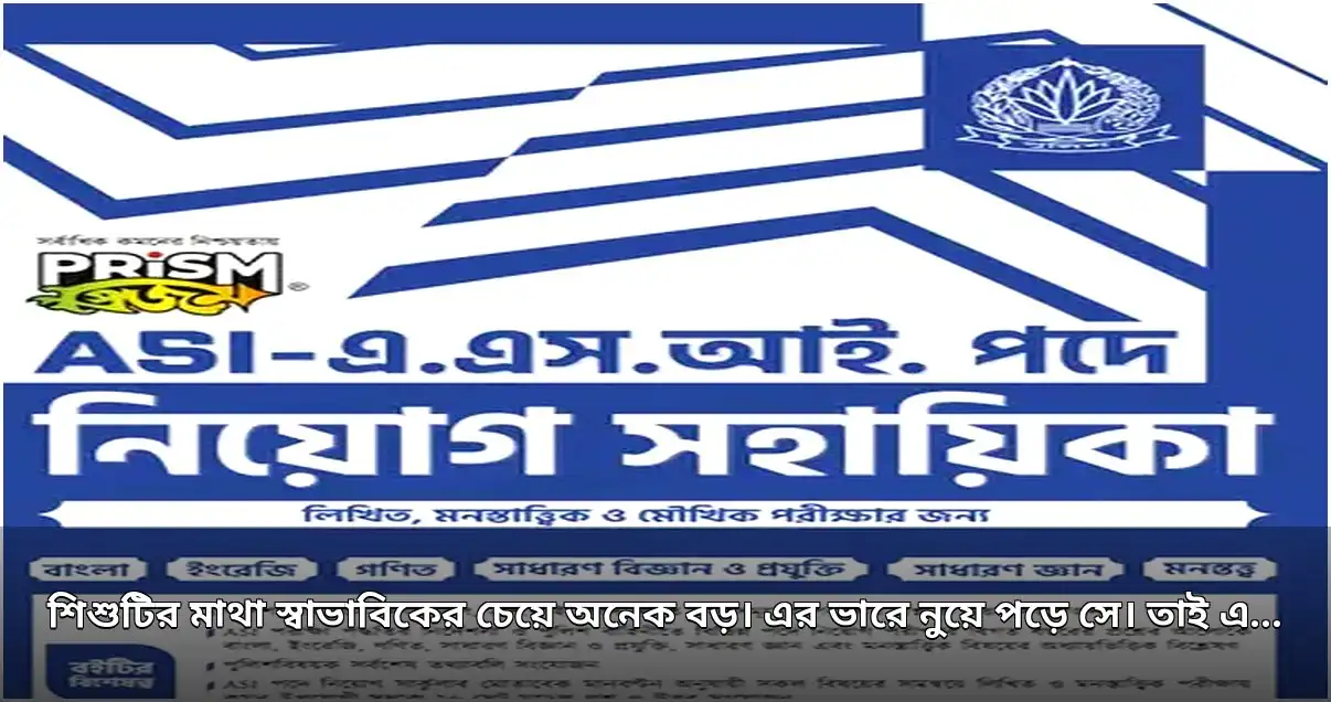 বড় মাথার যন্ত্রণায় ছটফট করা শিশু আরিফুলের জন্য আর্থিক সহায়তা প্রয়োজন
