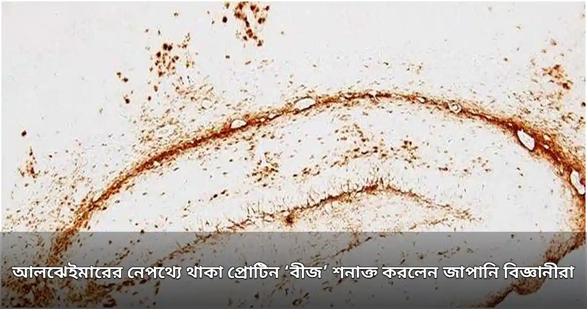আলঝেইমারের প্রোটিন 'বীজ' শনাক্ত করলেন জাপানি বিজ্ঞানীরা