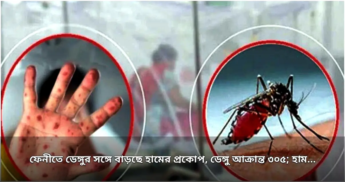 ফেনীতে ডেঙ্গু ও হামের প্রকোপ বৃদ্ধি, স্বাস্থ্য বিভাগ সতর্ক