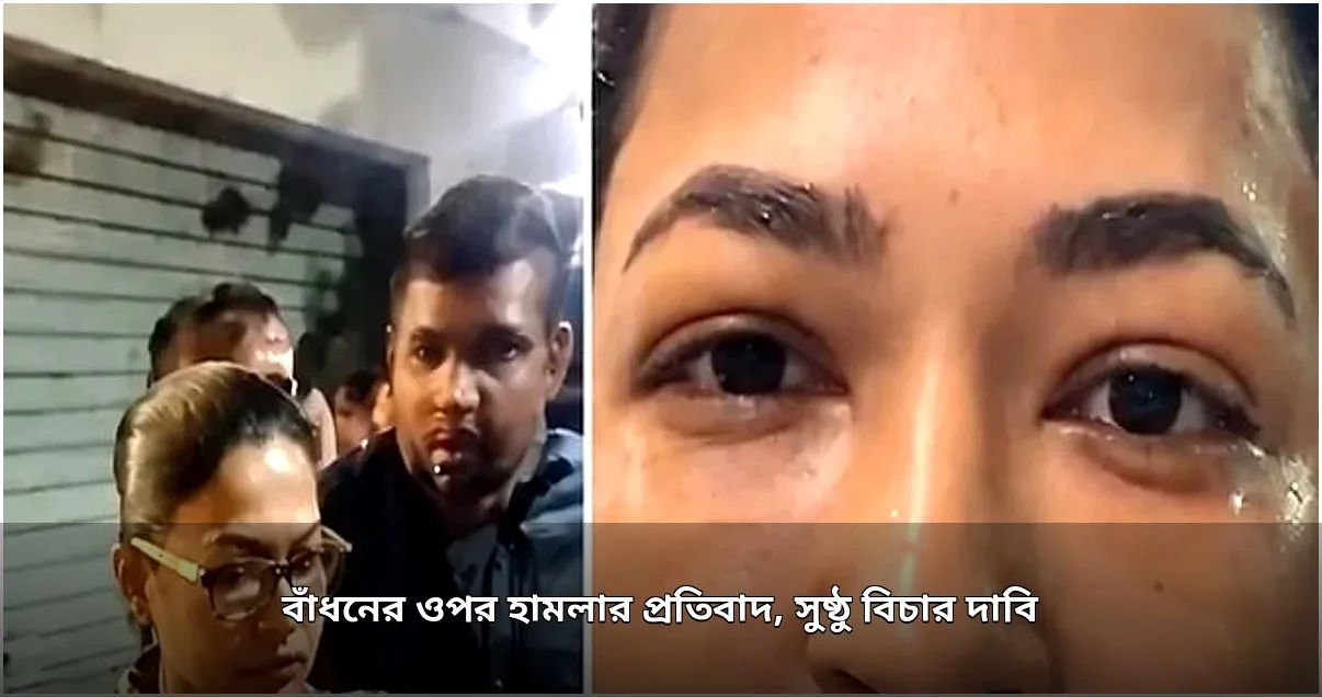 অভিনেত্রী বাঁধনের ওপর ইতালিতে হামলার প্রতিবাদ, বিচার দাবি দৃশ্যমাধ্যম সমাজের