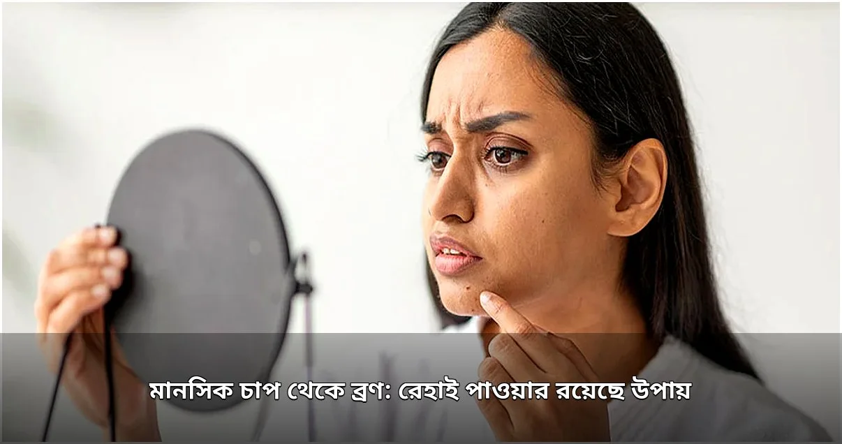 মানসিক চাপ থেকে ব্রণ: প্রতিকার ও প্রতিরোধের উপায়